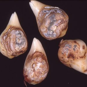 Penicilioze-tulpiu-ligos